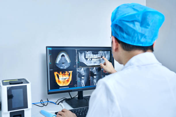 Best Emergency Tooth Extraction in Palm City, FL